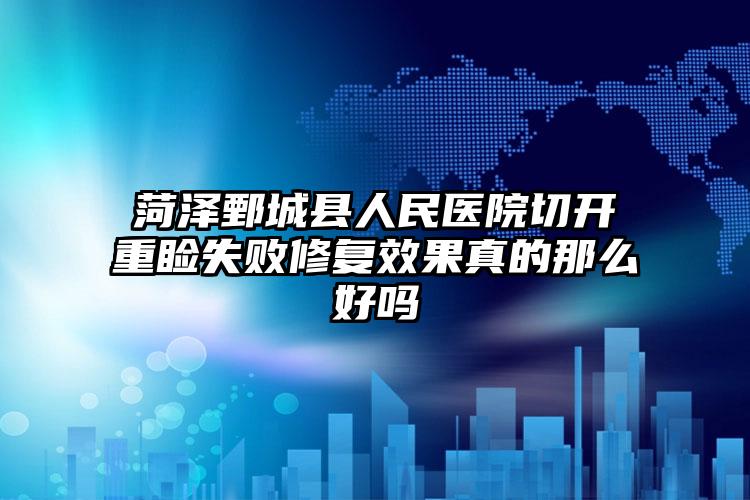 菏泽鄄城县人民医院切开重睑失败修复效果真的那么好吗