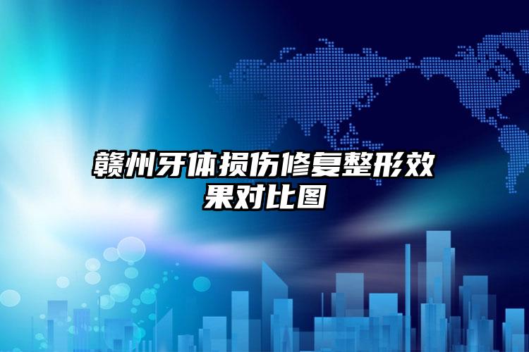 赣州牙体损伤修复整形效果对比图